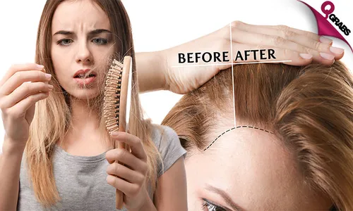 Anti-Hair Loss Treatment at DOT Beauty Salon!